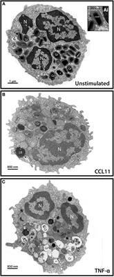 Single-Cell Analyses of Human Eosinophils at High Resolution to Understand Compartmentalization and Vesicular Trafficking of Interferon-Gamma